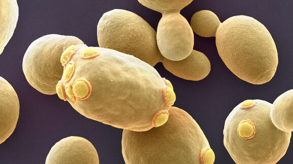 Puzzlopedia | Collection Fermentation energy