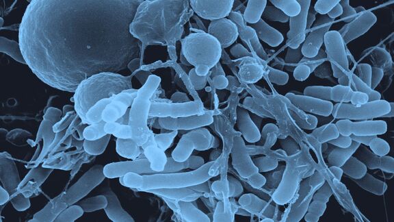 Puzzlopedia | Collection Poisoned by oxygen